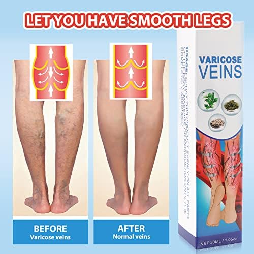 Tratamento de veias de varizes de 3pcs para pernas, spray de tratamento com veias de cicatrização