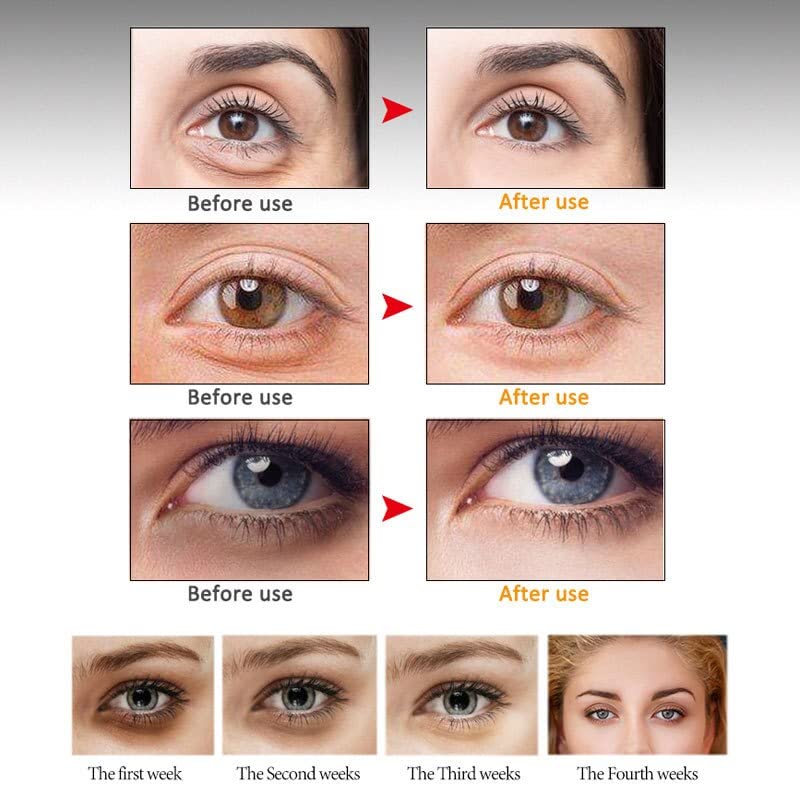Retinol Anti-Wrinkle Creme para os olhos Círculo escuro Remova sacos de olho de grânulos gordurosos Creme de