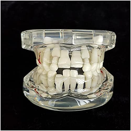 Modelo de dentes de dentes de dentes alternativos e permanentes do KH66ZKY
