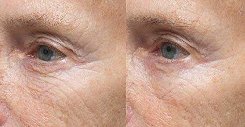 Dr. Denese Skinscience Hydroshield Eye soro Hidratação intensa para a pele em torno de olhos ricos em ceramidas,